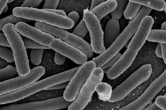 e coli bacteria